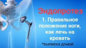 0.1 эндопротезирование тбс, выписали