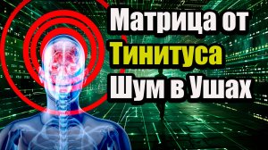 🎧 МАТРИЦА ГАРЯЕВА ОТ ТИНИТУСА – ИЗБАВЛЕНИЕ ОТ ШУМА В УШАХ 🎶✨