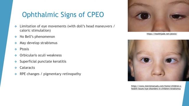 Kearns-Sayre Syndrome смотреть онлайн