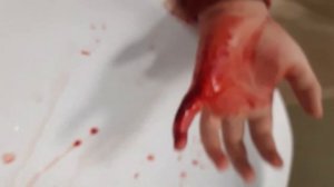 разбил стекло и поранил руку