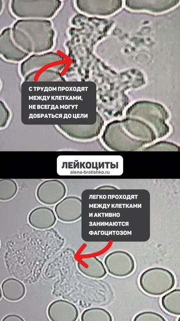 Нужно ли пить воду? Кровь под микроскопом. Алена Братишко смотреть онлайн