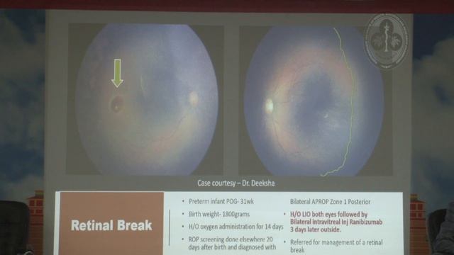 AIOCMTC1 2023 GP7 topic Dr SIMAR RAJAN SINGH Anti VEGF Agents for Retinopathy of Prematurity P смотреть онлайн