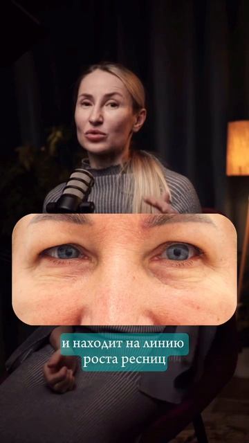 Неожиданные плюсы от блефаропластики