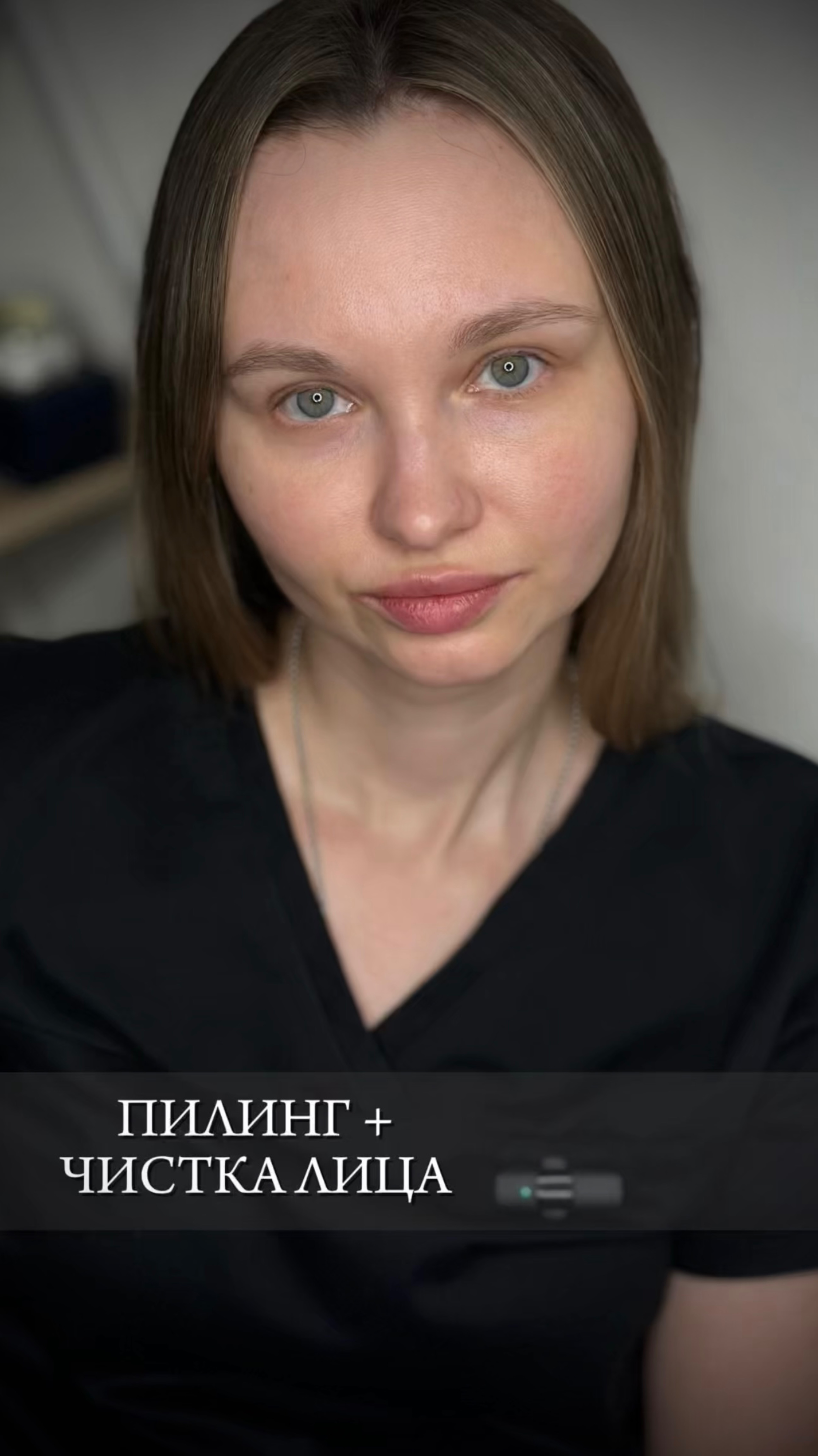 Вся правда о пилингах и чистках лица смотреть онлайн
