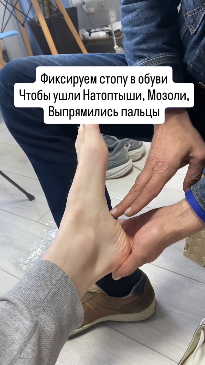 Обуваемся и шнуруемся, чтобы ровно ходить и избавиться от #натоптыши #кривыепальцы #косточка #шпора смотреть онлайн