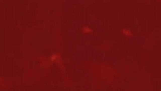 Эдит spring trap (не мой)