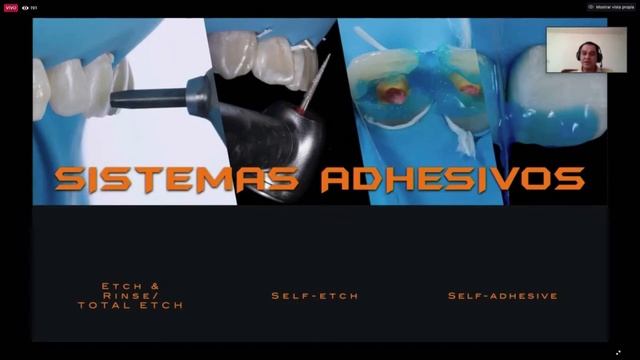 1062 Criterios estéticos en la selección de cementos: Pros y Contras смотреть онлайн