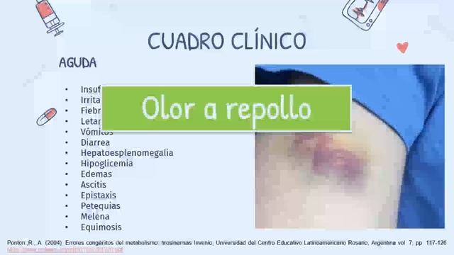 Metabolismo de tirosina: Tirosinemias смотреть онлайн