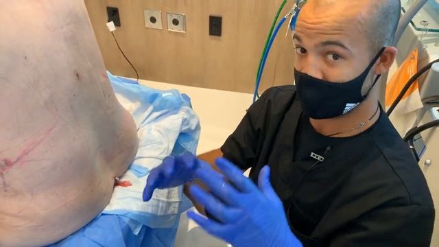 DAY 1 POST-OP 360 HD-LIPO | LYMPHATIC DRAINAGE MASSAGE | Dr. Jason Emer смотреть онлайн