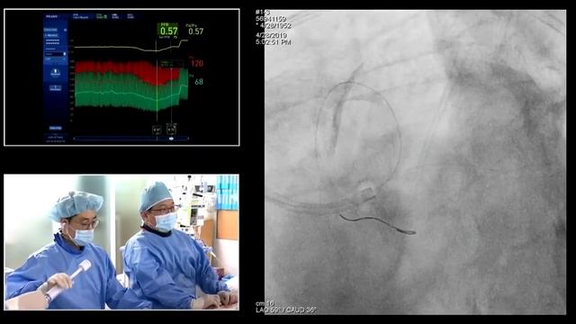 [TCTAP 2019] Coronary Symposium - Live Case & Lecture Session I смотреть онлайн
