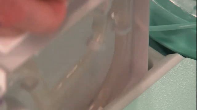 Подготовка к процедуре вакуумной биопсии смотреть онлайн