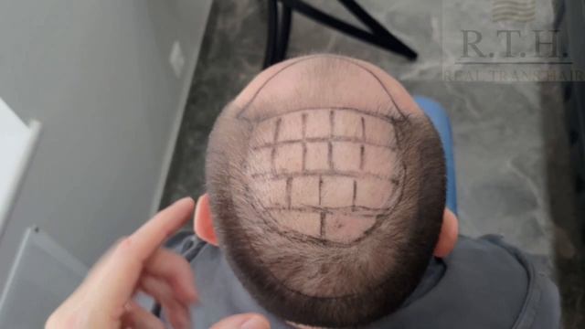 Шестая степень облысения☀️ смотреть онлайн