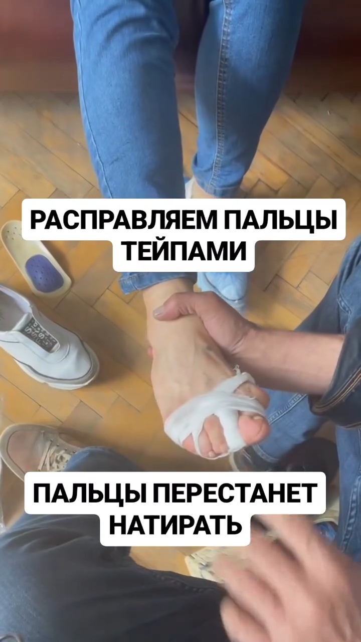 Возвращаем пальцам жизнь с помощью тейпов и стелек #тейпирование #тейп #тейпированиеног #натоптыши смотреть онлайн