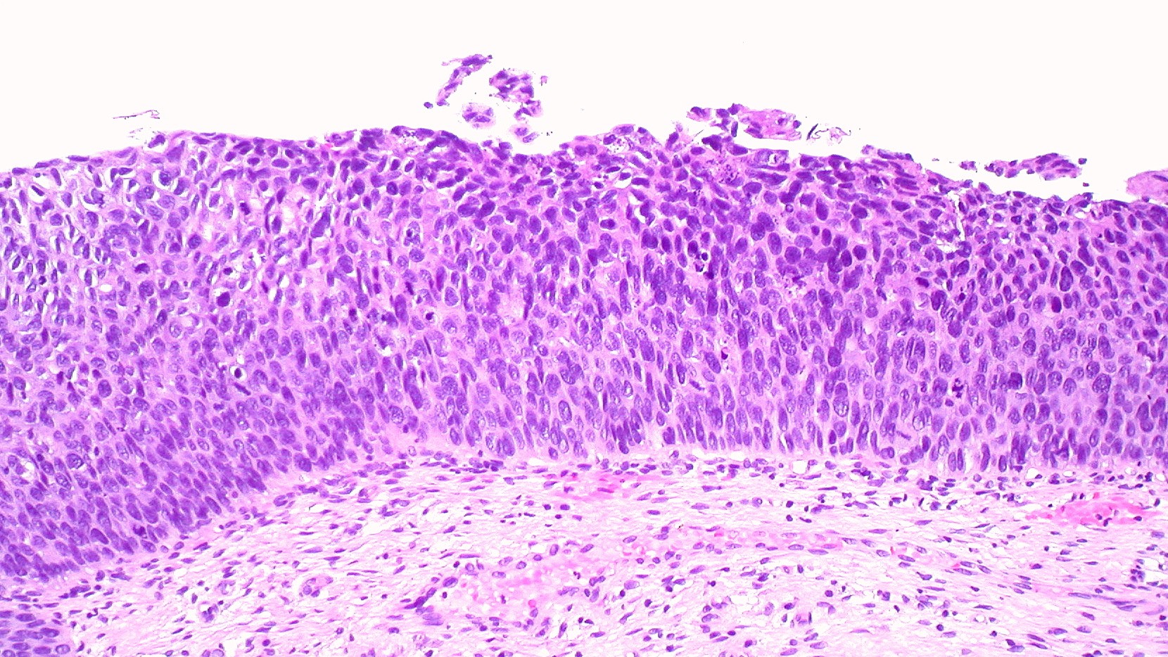 Патологическая анатомия заболеваний половых органов смотреть онлайн