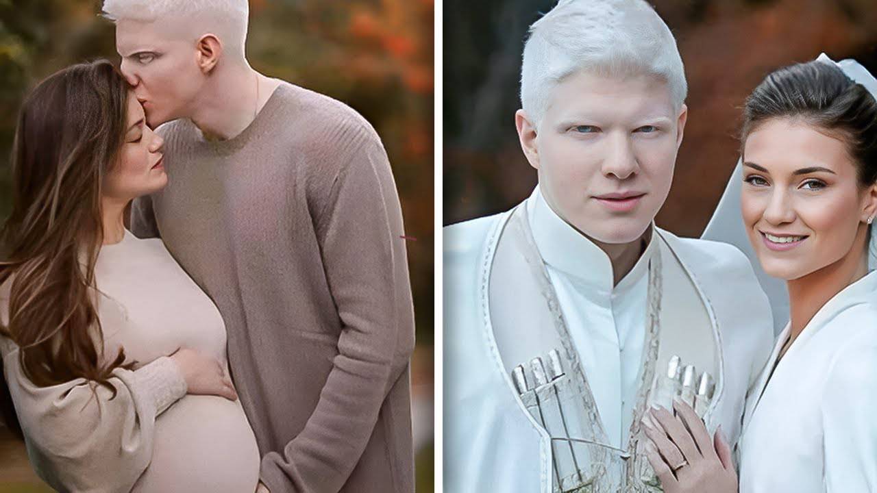 Что случилось с детьми самого красивого альбиноса в мире? смотреть онлайн