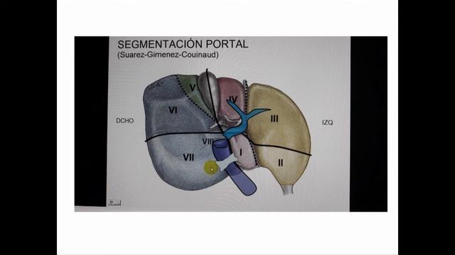 Anatomía Quirúrgica Hepática