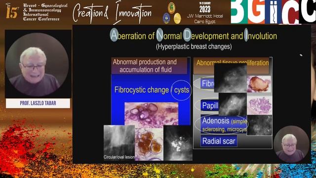 Differential diagnosis of lesions with radiation structure by Prof Laszlo Tabar 2 смотреть онлайн