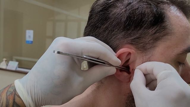 Como aplicar piercing tragus e helix смотреть онлайн