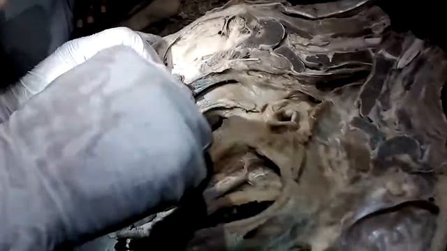 Cavidad nasal anatomia смотреть онлайн