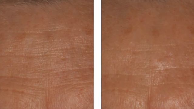 Welcome SkinBetter Science to Melinda Menezes, MD смотреть онлайн