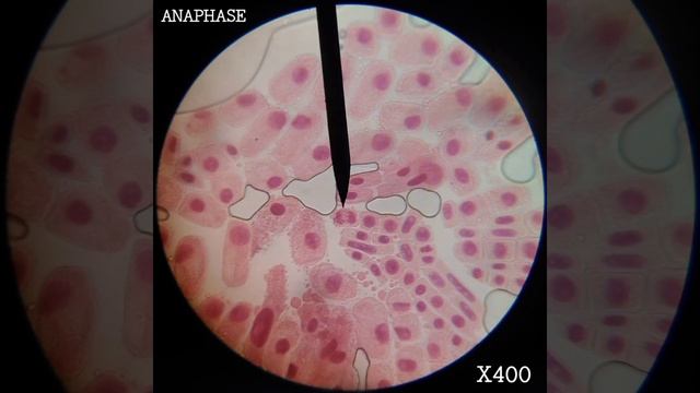 ONION ROOT TIP CELL DIVISION STAGES (MAGNIFICATION : X400) смотреть онлайн