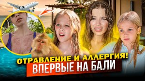 ВПЕРВЫЕ на БАЛИ ! ОТРАВЛЕНИЕ и АЛЛЕРГИЯ ! ПОЧЕМУ БОЛЬШЕ не ВЕРНЕМСЯ СЮДА !