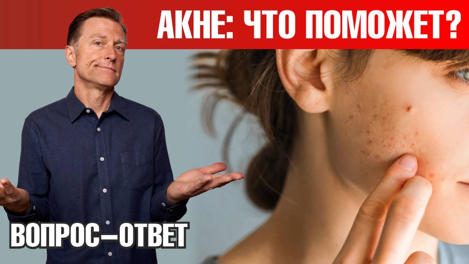 Акне? Прыщи? Самый главный минерал, если у вас кистозное акне🙌 смотреть онлайн