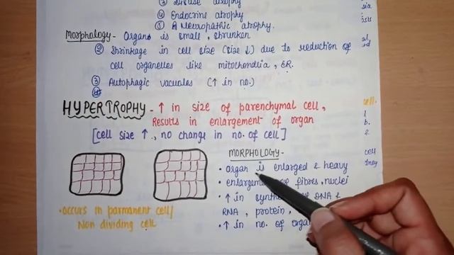 Cell Injury & Adaptation - definition || Atrophy, Hypertrophy ,Hyperplasia, Metaplasia & Dysplasia смотреть онлайн