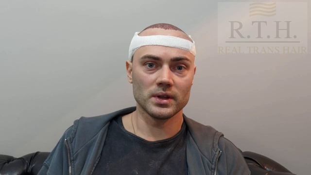 Как выглядит и чувствует себя пациент сразу после пересадки волос смотреть онлайн