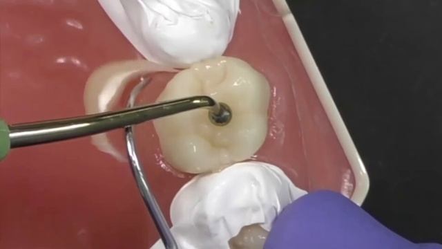 How To Easily Remove The Excess When Luting With GC G Cem One смотреть онлайн
