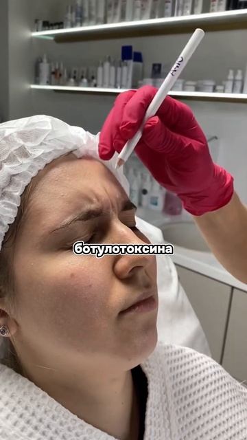 Почему появляются новые морщины после ботокса? смотреть онлайн