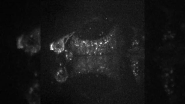 2-photon Camera-based lightsheet microscopy of live zebrafish смотреть онлайн