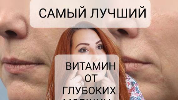 Витамин разглаживает морщины.Маска молодости.Делаю сама и молодею. смотреть онлайн