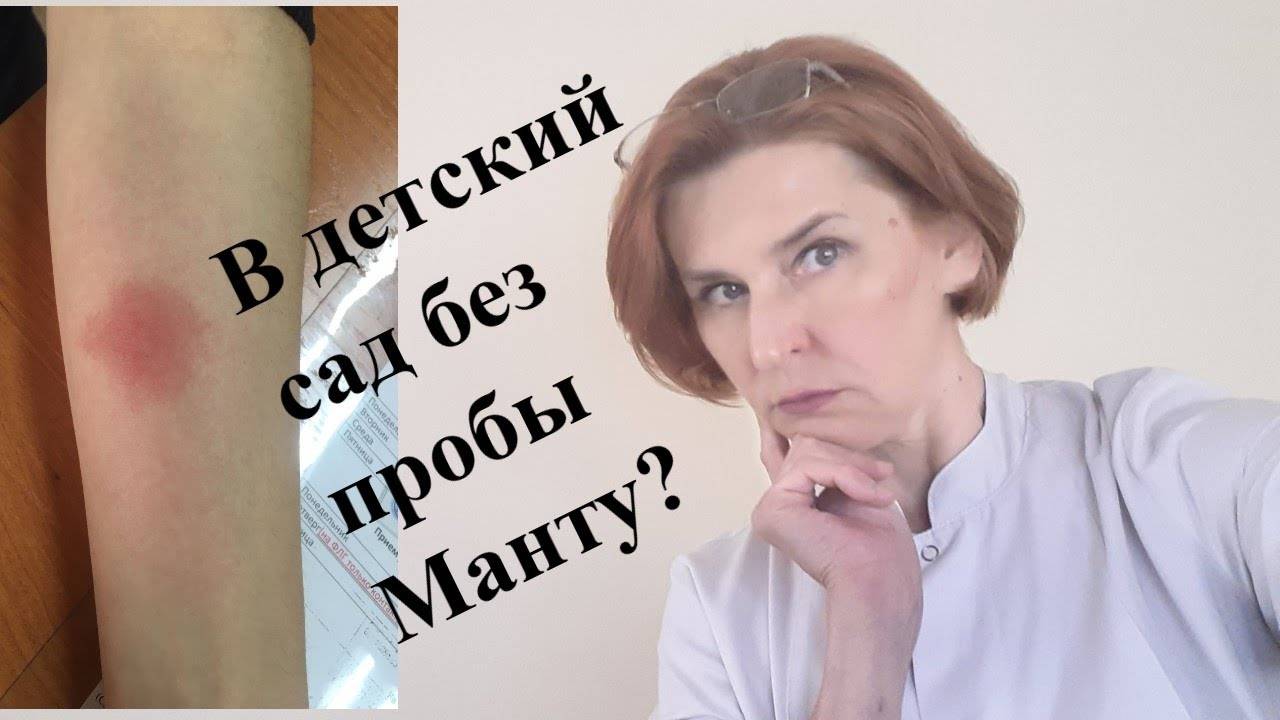 В детский сад без пробы Манту смотреть онлайн