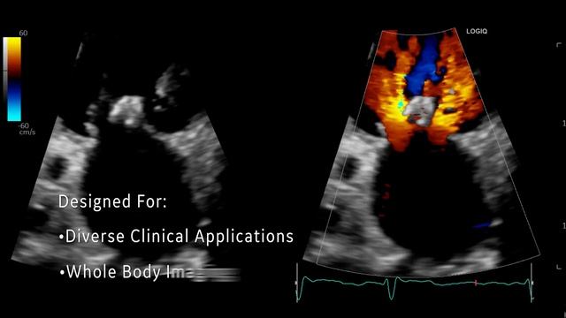 LOGIQ™ E10s Multi-Purpose Ultrasound смотреть онлайн