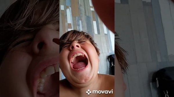 муха кусает