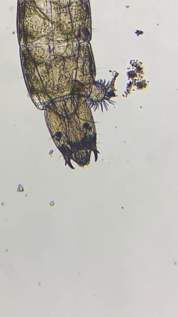 Mosquito larvae under a microscope #smallyoutuber #microbiology #biology #shorts смотреть онлайн