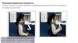 Позиционирование пациента на компьютерном томографе Vatech А9