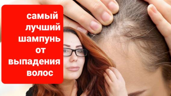 Сильный шампунь от выпадения волос.У меня больше никогда не выпадают волосы.рекомендую. смотреть онлайн
