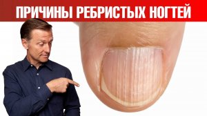 О чем кричат ваши ногти? Не лечите симптом, ищите ПРИЧИНУ✅
