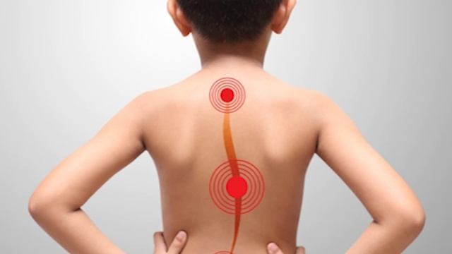 ПОМОЧЬ ВОВРЕМЯ | Как предотвратить детский сколиоз?