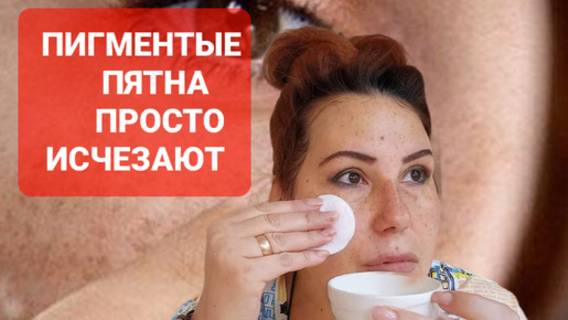 Тёмные пятна на лице убираю просто.Домашняя простая маска от пигментных пятен на коже. смотреть онлайн