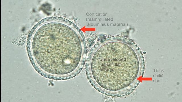 Ascaris lumbricoides- eggs смотреть онлайн