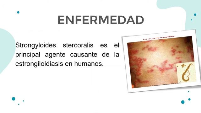 6LM2. Fase VI - Nemátodos: Strongyloides stercoralis. | IPN: CECyT 16 смотреть онлайн
