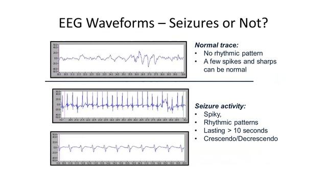 How to read neonatal aEEG - LIVE Q&A with Kathi Randall, NNP смотреть онлайн