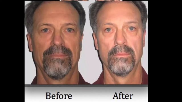 Sublime Instant Lift- Anti Aging Solution смотреть онлайн