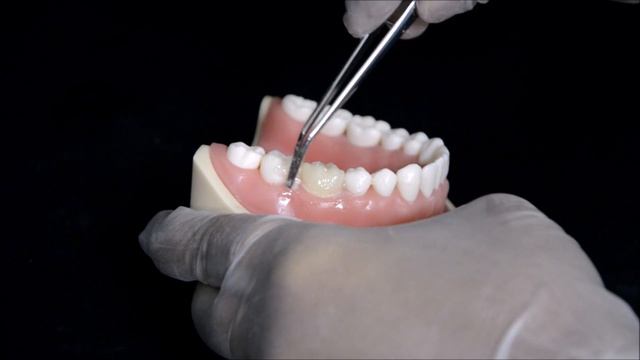 PROVISIONAL RESTORATION - DIRECT TECHNIQUE - SINGLE CROWN смотреть онлайн