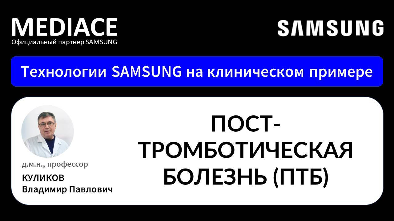 Посттромботическая болезнь (ПТБ). Протокол УЗИ на клиническом примере