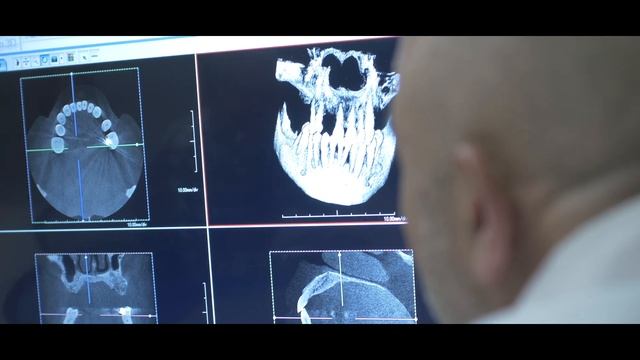 Richard's Story-The Power of Full Arch Dentistry Beyond Simply Replacing Missing Teeth смотреть онлайн