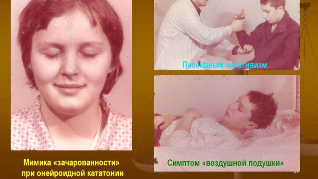 Симптом Рюмке смотреть онлайн